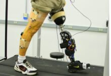 robotic prosthetic
